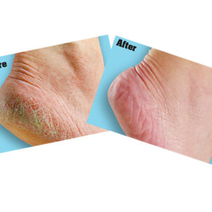 O'Keeffe's Healthy Feet Foot Cream  85g Tube