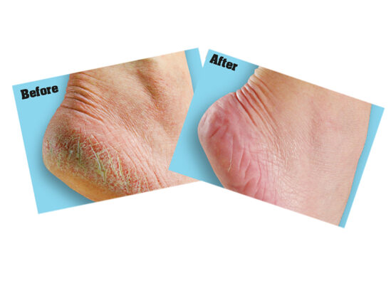 O'Keeffe's Healthy Feet Foot Cream  85g Tube